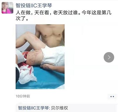 BRC贝尔链崩盘！贝尔链领导人被砍残废 其余团队长人人自危